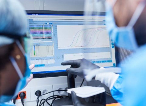 SFI research could predict strokes in younger people more accurately